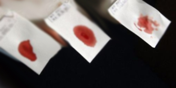 绵阳哪里找正规亲子鉴定机构,<a href=
