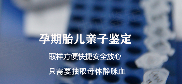 绵阳怀孕怎么做亲子鉴定,绵阳怀孕做亲子鉴定流程是什么 绵阳怀孕怎么做亲子鉴定,绵阳怀孕做亲子鉴定流程是什么