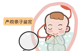 绵阳怀孕5周可以做孕期亲子鉴定吗，绵阳做无创孕期亲子鉴定收费多少